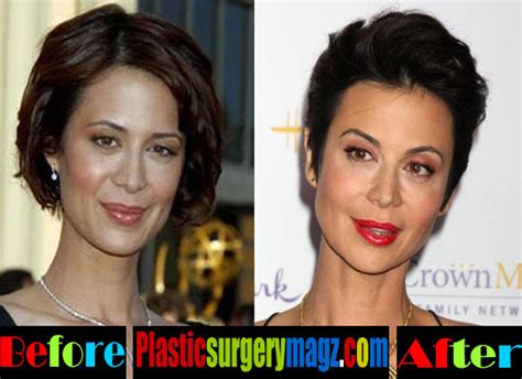 Catherine Bell Plastic Surgery Before And After Plastic Surgery