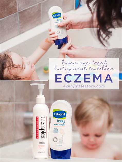 How We Treat Baby And Toddler Eczema Toddler Eczema Eczema Baby Eczema