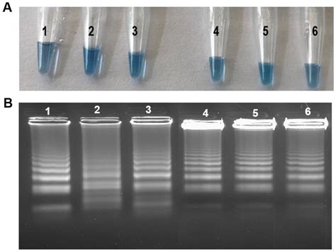 By continuing to use aliexpress you accept our use of cookies (view more on our privacy policy). Comparison of LAMP assay using Bst 3.0 polymerase with ...
