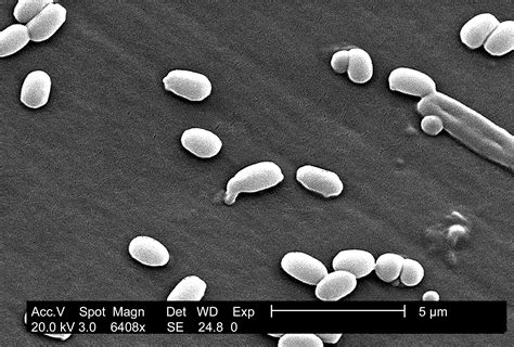 Free picture: characteristic, aimes, strain, anthracis, smooth, surface