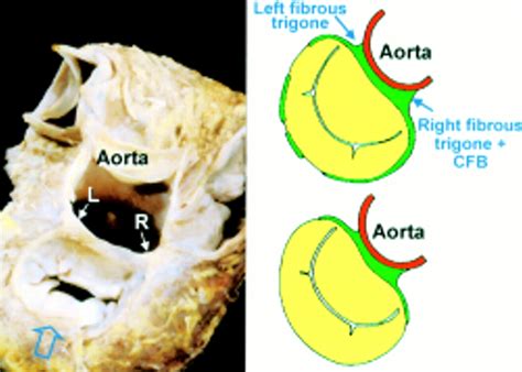 Anatomy Of The Mitral Valve Heart