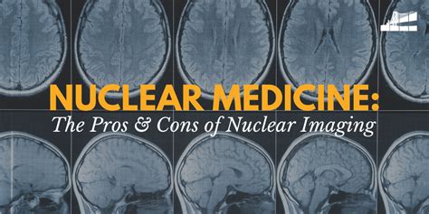 Nuclear Medicine The Pros And Cons Of Nuclear Imaging — Bay Imaging
