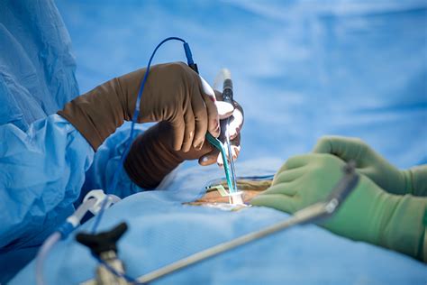 Less Is More Minimally Invasive Surgery Delivers Big Results Ucsf