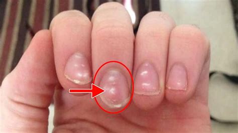 Incredible White Things On Nails Meaning References Fsabd42