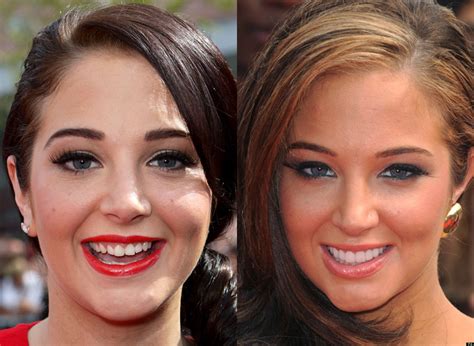 Celebrity Teeth Before And After Stars Whove Had Dental Work