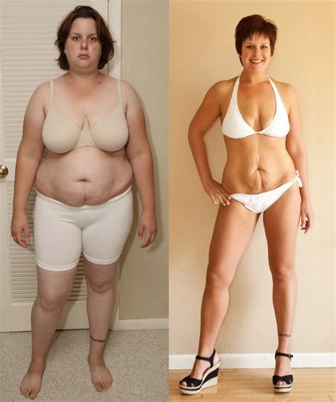 Kg Weight Loss Before And After Pictures Craftsgala