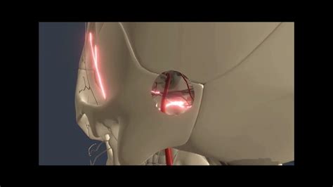 Trigeminal Neuralgia Pain Relieving Surgery Youtube