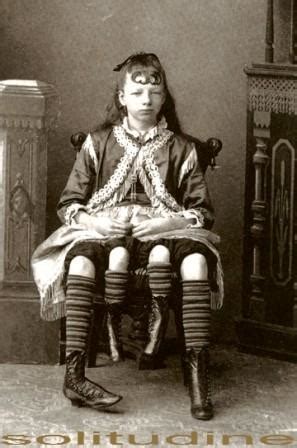12 мая 1868, линкольн, теннесси —6 мая 1934, клебурн, техас) — американка, родившаяся с удвоенным тазом и четырьмя ногами на втором тазу. Manusia - Manusia Terunik di Dunia | Informasi Gila