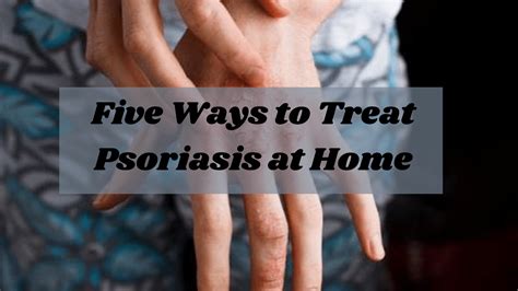 Five Ways To Treat Psoriasis At Home