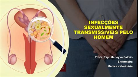 Nem Todas As Infecções Sexuamente Trasmitiveis Possuem Sintomas Sendo Assim