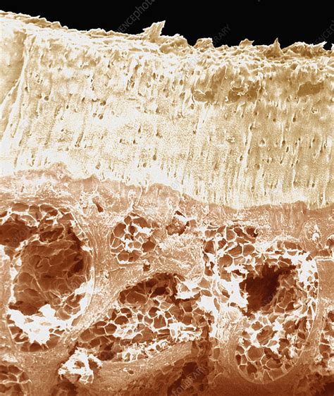 No need to register, buy now! Bone articular surface cross-section. SEM - Stock Image - C005/2642 - Science Photo Library