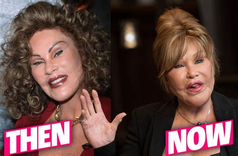 ‘catwoman Jocelyn Wildenstein Says Shes Never Had Plastic Surgery