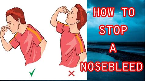 How To Stop A Nosebleed First Aid For Nose Bleeding At Home Youtube