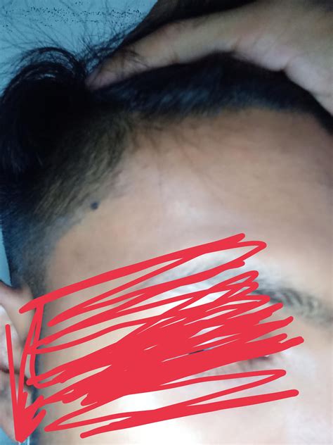 I've noticed my hairline has gone back a bit. Am I really balding? : r