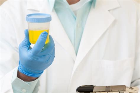 New Urine Based Kidney Stone Test Delivers Results In 30 Minutes