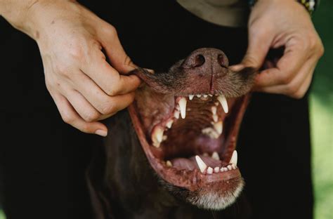 Doenças Periodontais Causam Risco à Saúde E Migração De Bactérias Para