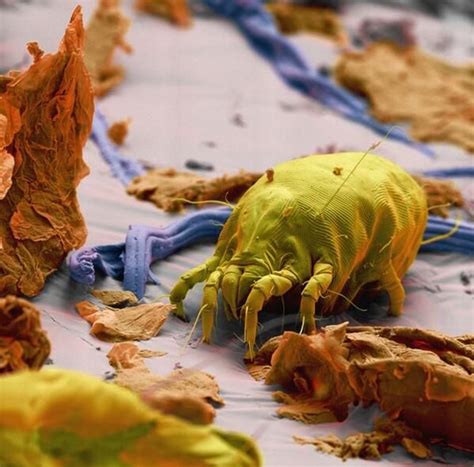 Dust Mite Eating Human Skin Electron Microscope Images Scanning