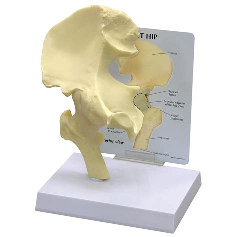 Basic Hip Model 1019503 1260 Bone Models Human Skeleton Models