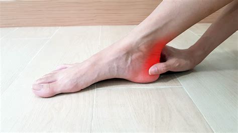 Ways To Treat Heel Bone Spurs Foot And Ankle Group