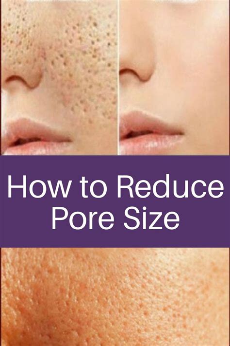How To Reduce Pore Size In Reduce Pore Size Huge Pores Reduce Pores