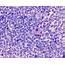 Mast Cell Archives  EClinpath