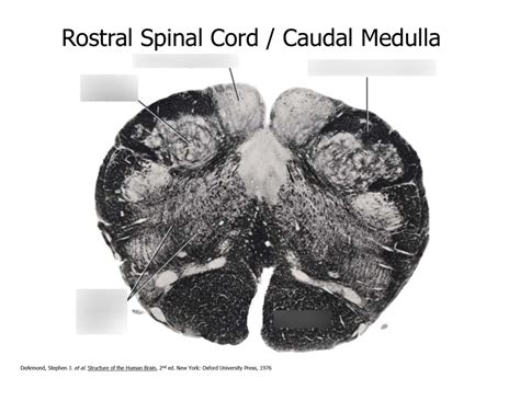 NHN Rostral Spinal Cord Caudal Medulla Diagram Quizlet