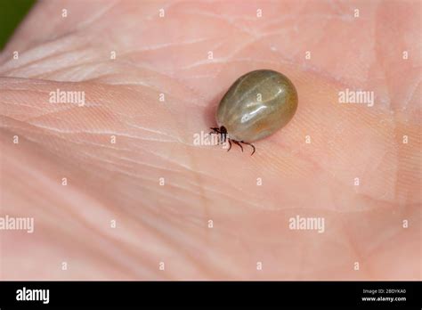 Large Fully Engorged Tick Walking On Human Skin Macro Shot Stock Photo