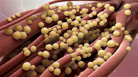 Staphylococcus Aureus Infection Health Hearty