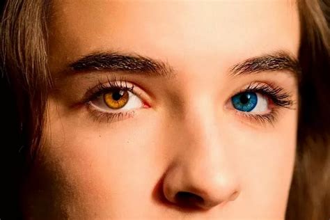 Интересные факты о Гетерохромия глаз что это такое у людей