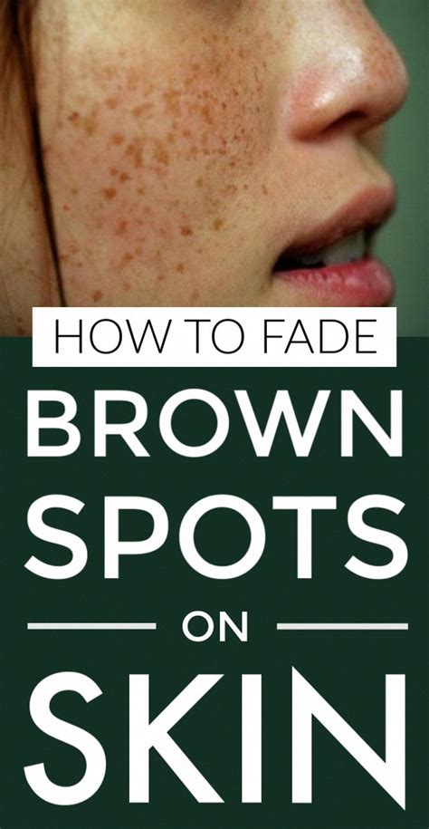 How To Get Rid Of Brown Spots On Face Brownspotsonface