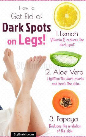 You can also mix it with honey if you want results that are much better in fading the annoying spots. How to Get Rid of Dark Spots on Legs with Easy Natural ...