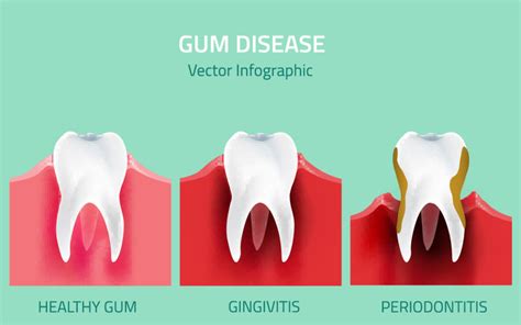 How Does Gum Disease Affect Your Overall Health