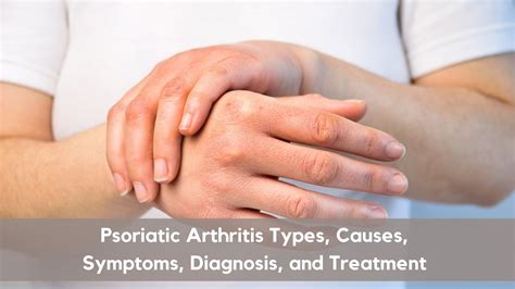 Everything You Need To Know About Psoriatic Arthritis Vims