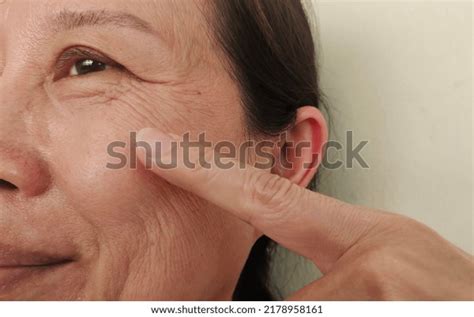 Portrait Showing Flabbiness Adipose Sagging Skin Stock Photo 2178958161