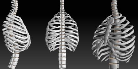 The ribs are a set of twelve paired bones which form the protective 'cage' of the thorax. Rib Cage - Assignment Point