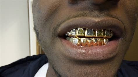 18 Ct Real Gold Grillz