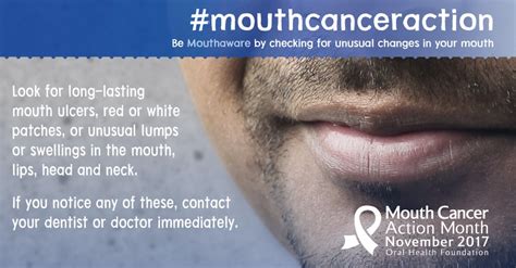 Mouth Cancer Action Month Southampton