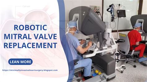 Robotic Mitral Valve Replacement Minimally Invasive Heart Surgery