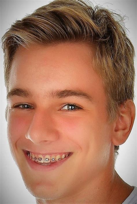 Guys With Braces Adult Braces Perfect Teeth Haircuts Box Pins