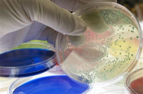 Bacterial Colonies Image Eurekalert Science News Releases