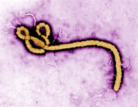 Liberian Woman Appears To Have Contracted Ebola Through Sex With Survivor