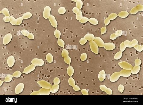 Diplococci Bacteria Stock Photos And Diplococci Bacteria Stock Images Alamy