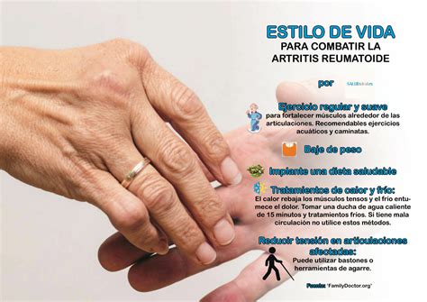 La Importancia Del Tratamiento Temprano De Artritis Reumatoide El My