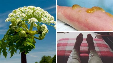 Britains Most Dangerous Plant Giant Hogweed Spreads In Heatwave
