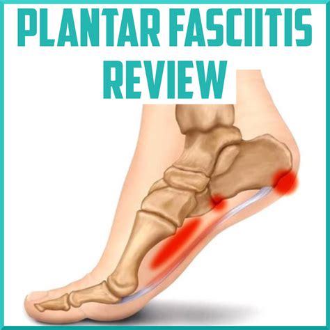 Plantar Fasciitis Symptoms And Causes Mayo Clinic Vlr Eng Br
