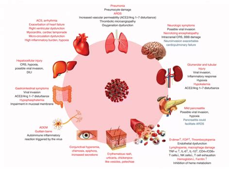 Pathogenesis Clinical Manifestations And Complications Of Coronavirus