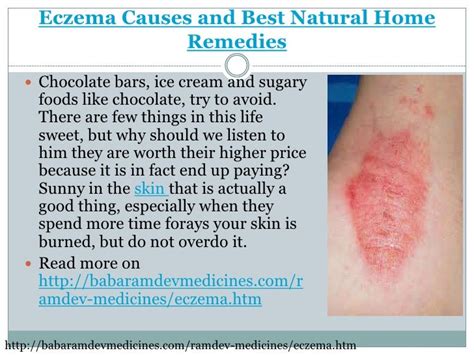 Eczema Causes And Best Natural Home Remedies