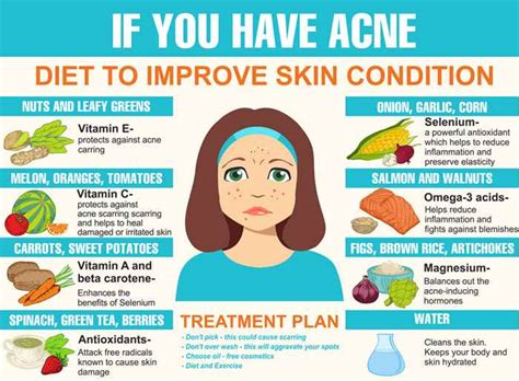 Best Foods For Acne Free Skin Infographic