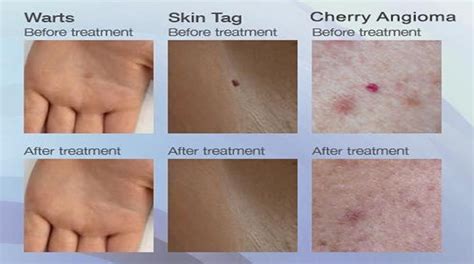 Ever Wondered Exactly What Do The Red Dots On Your Skin Mean Page 3