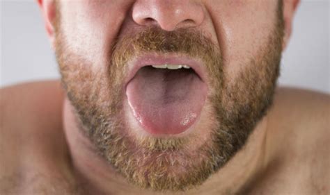 Tongue Cancer Early Signs A Sore Throat That Wont Go Away Is Just One